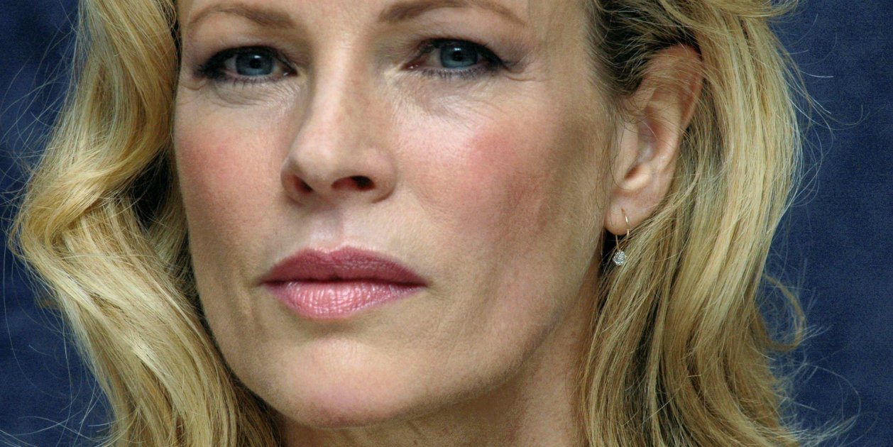 The Image Of The 69 Year Old Actress Unrecognizable By Botox