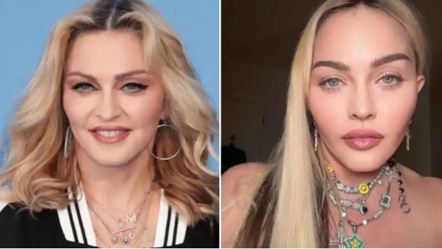 Madonna antes y después