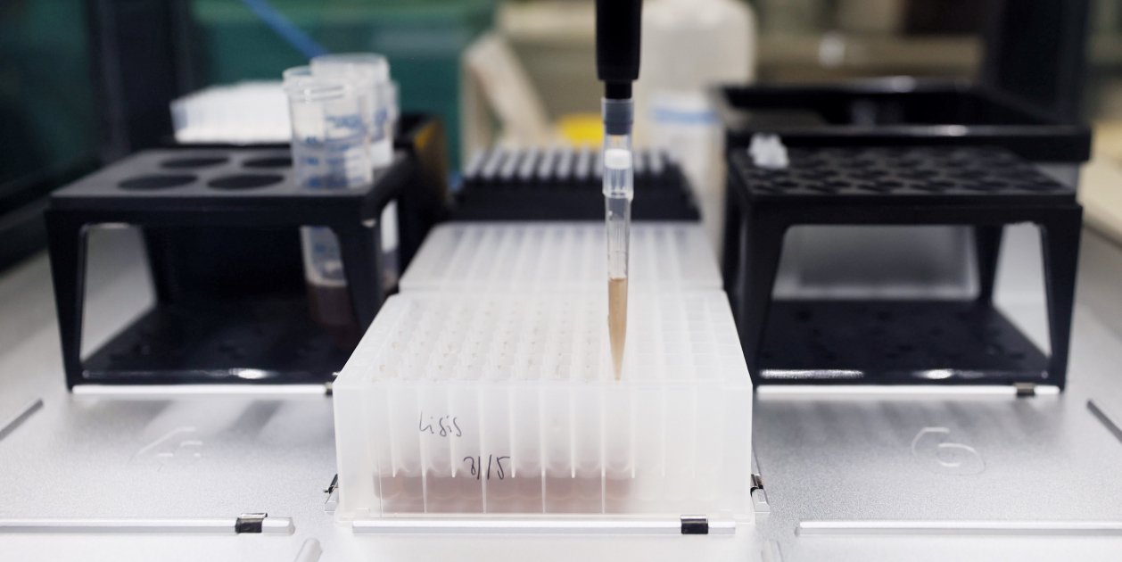 Pruebas PCR para viruela del mono en hospital de Madrid   Europa Press