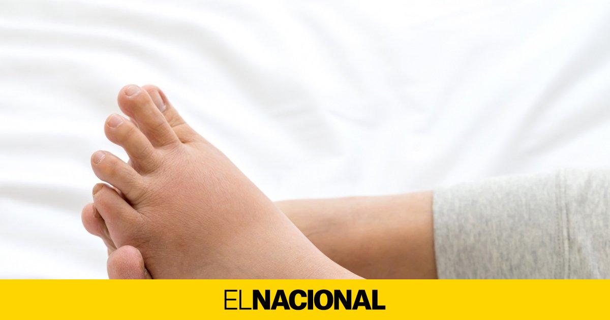 Masajes para los pies hinchados hot sale