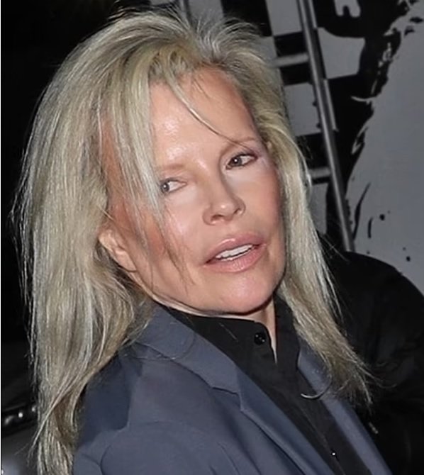 Kim Basinger ya no es así: la imagen de la actriz de 69 años, irreconocible por el bótox