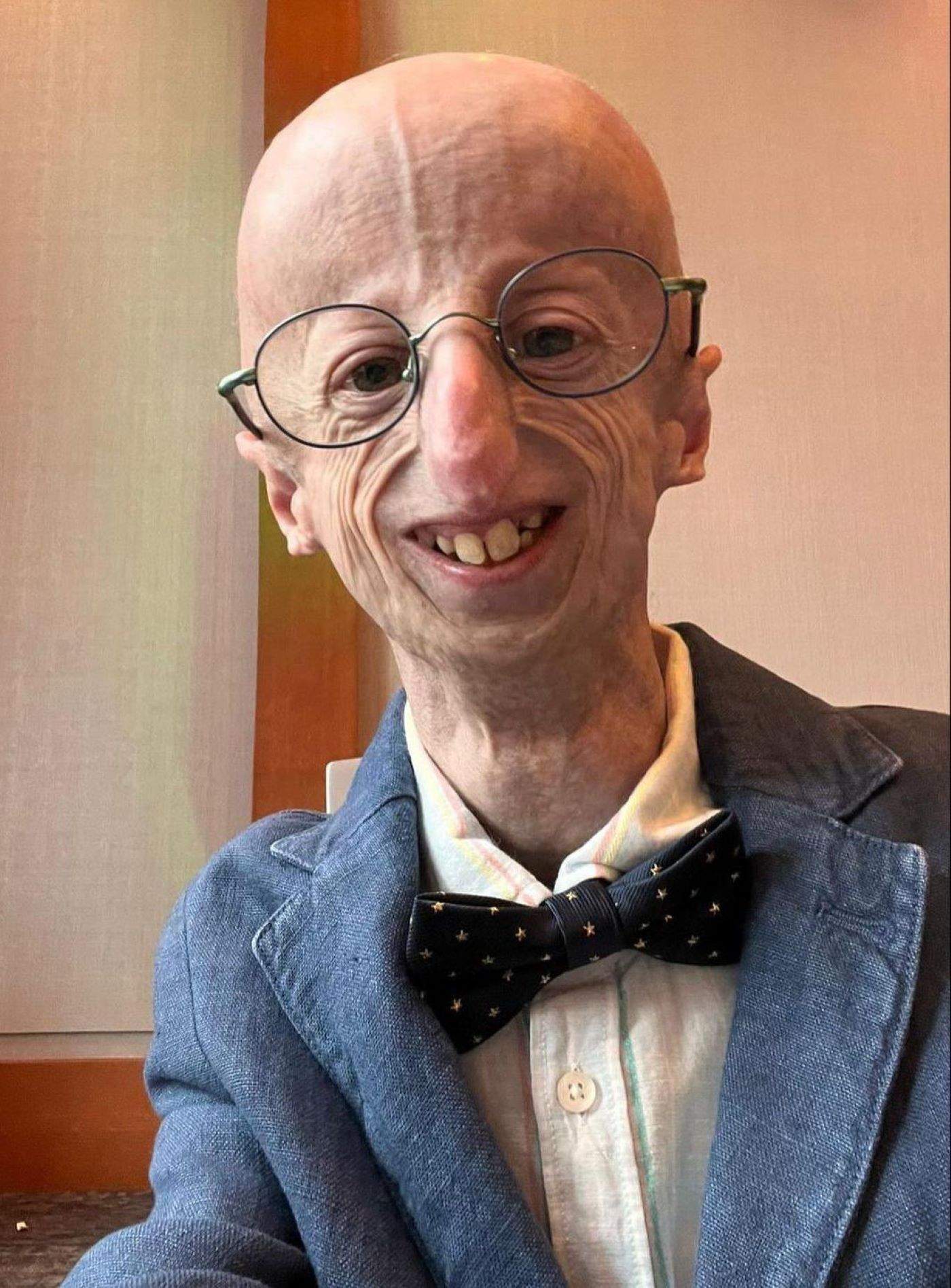 Muere Sammy Basso, el científico italiano que visibilizó la progeria, a los 28 años