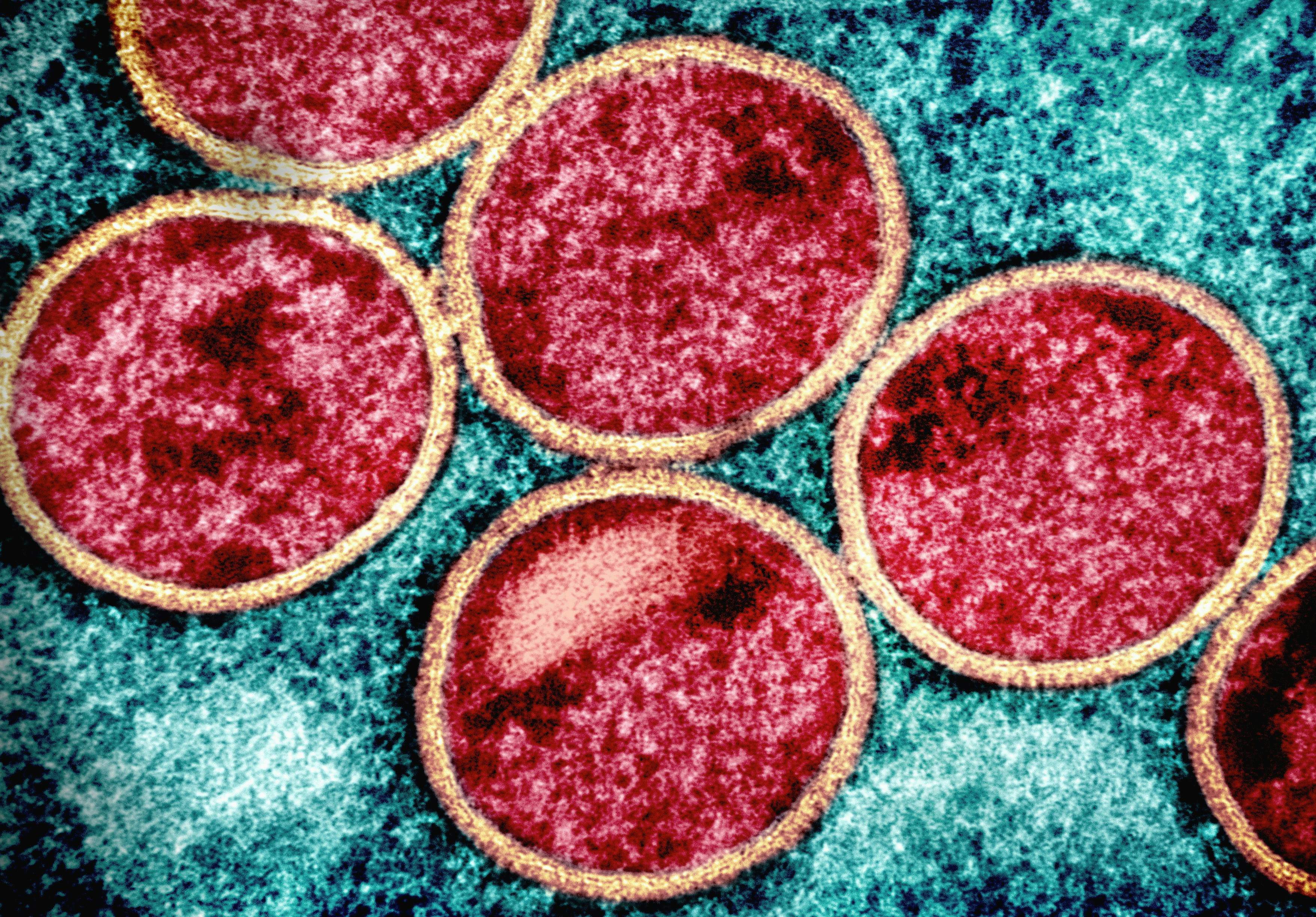 ¿Pánico en EE. UU.? Detectan la cepa más grave de viruela del mono y un extenso brote de 'E. coli'