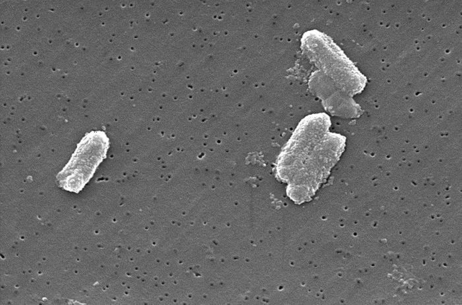 Alerta europea por unas bacterias resistentes a antibióticos: "Suponen una amenaza"